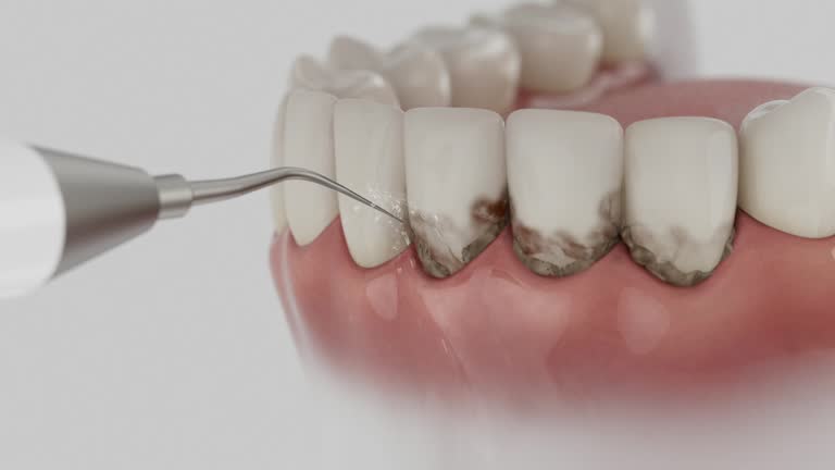 Reliable Dental Implants contractor in Apple Mountain Lake, VA by Smile Center Dentistry